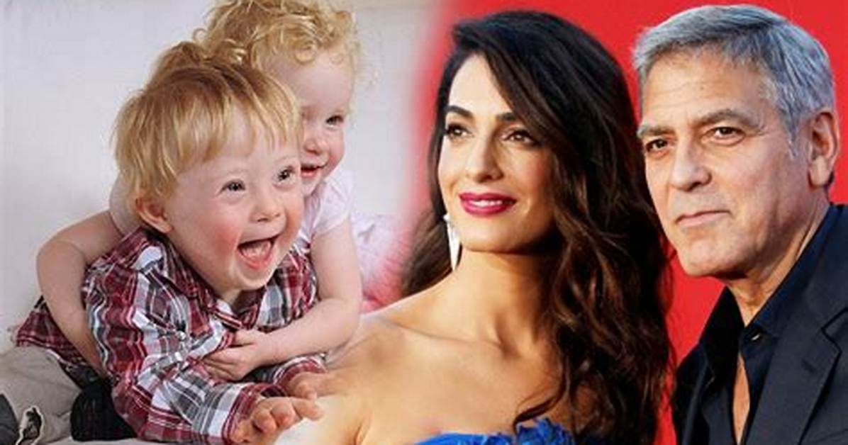 George Clooney Twins Down Syndrome: Ella and Alexander Clooney Health Update 2023
