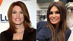 Kimberly Guilfoyle Face Lift: a Deep Dive into Her Transformation