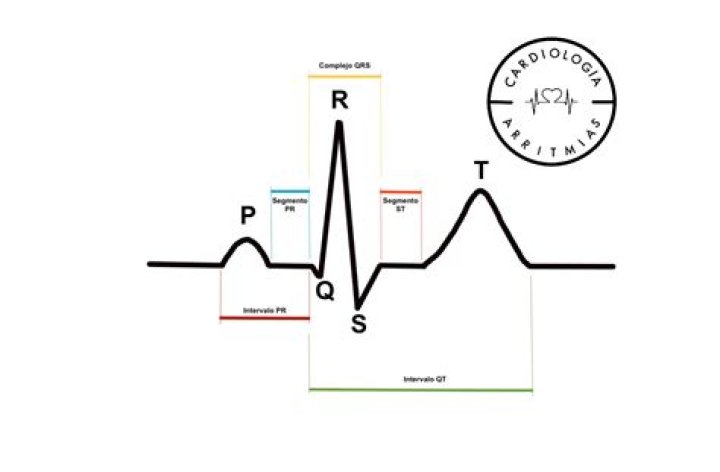 NDAs what normal controls on this acts the ampere precise jurisprudence